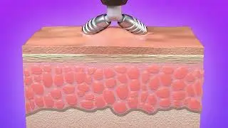 SKNLAB Balance Handpiece Animation | 3D Medical Cross Section Animation