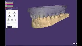 VITA DENTAL LAB