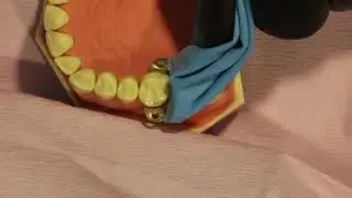 digue unitaire méthode parachute