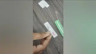 HIV Test कैसे किया जाता है | How is HIV test done? #hivtest #viral #shorts #aids #ELISA #hospital 