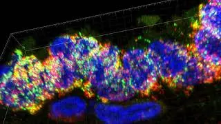 21-Month Human Lung 17235 SFTPB and ABCA3 Enhanced Resolution_001