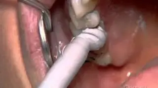How Digital Dentistry Works {www downloadshiva com}