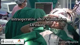 Spinocerebellar Ataxia-12 Treatment by Dr. Paresh Doshi
