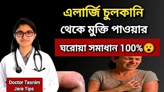 এলার্জি চুলকানি থেকে মুক্তির ঘরোয়া উপায় 100% 🔥 | Allergy Itching Treatment at Home | Doctor Tips 