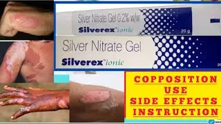 Silverex ionic gel uses in hindi | Silverex ionic gel Silver nitrate gel 0.2% w/w/Silver nitrate gel