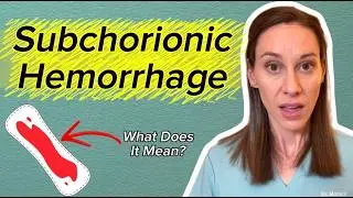 Bleeding In Pregnancy? Understanding Subchorionic Hemorrhage (OBGYN Explains)