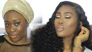 WATCH ME TRANSFORM: FROM HOUSEGIRL😔 TO HOMEGIRL! 💃🏽 (HYPER-PIGMENTED SKIN)