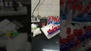 Pathology Laboratory Test kayse karte he #dmlt #microbiology #biology #bmlt #chemistry #pathology