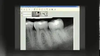 Westminster Dentist Mar2014