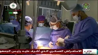 أول عملية زرع جهاز المساعدة البطينية للقلب