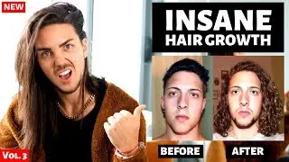 ✅ Awkward Stage Inspiration - Reacting to INSANE Hair Growth Time Lapses Ep3