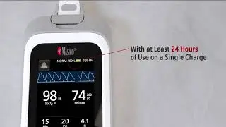 Masimo Rad-G&trade; Pulse Oximeter with Sensor