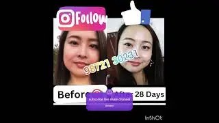 Full guarantee result 🔷️ Lab 🧪tested product ✅️ Camical free  #shortvideo #youtube all information👇👇