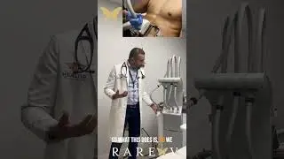 SculpSure Laser Fat Reduction