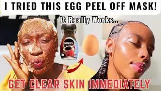 I Tried the VIRAL Egg White & Coffee Mask for Acne & Blackheads | SHOCKING RESULTS!