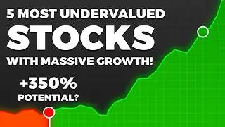 The ONLY 5 Undervalued Stocks You Need to Watch for 2026 (Massive Growth Alert!)
