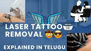 Laser Tattoo Removal Explained Step by Step | Science, Safety & Results in TELUGU!!
