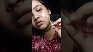 Old video👀 fevikwik দিয়ে tan remove করলাম😱 #minivlog #shorts #hack #viralvideo
