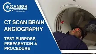 CT Scan Brain Angiography - Test Purpose, Preparation & Procedure | Ganesh Diagnostic
