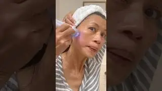 Microdermabrasion at home kit. A great investment for your skin. #skincareroutine #over50skin