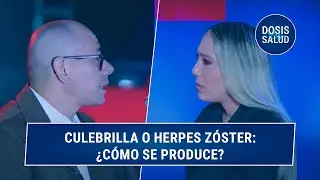 Herpes Zóster: La reactivación del virus de la varicela en adultos | Dosis de Salud