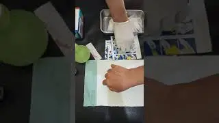 Cara Marawat Luka secara Mandiri pada Penderita Diabetes