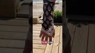 Gips Modern (Cast 21) Solusi Perawatan Lengan Patah Tulang #teknologi #cedera #education #shorts
