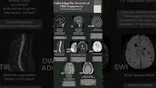 some basics of MRI sequences. Credit: Dr Robert Mariasi