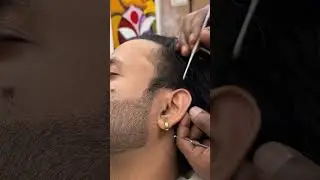 Intense Wax Removal and Deep Ear Cleaning by MASTER CRACKER💈#asmr #shorts #earwaxremoval