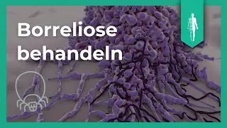 Diagnose & Behandlung von Borreliose: Das ist zu beachten! Dr. Armin Schwarzbach