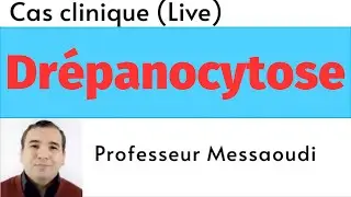 Drépanocytose [Cas clinique]