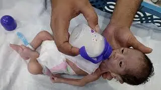 Preterm Baby Feeding Guide | Step-by-Step Bottle Feeding in NICU Care
