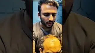 Hair Replacement Center Since1950 #tiktok #youtubeshorts