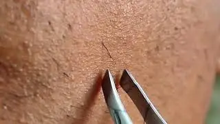 From Stubble to Style The Art of Selective Beard Plucking: Help Me Reach 1000 Subscribers