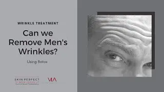 Do Men Get Botox to Remove Wrinkles?  | Skin Perfect Brothers