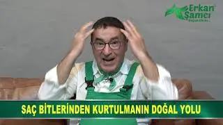 Erkan Şamcı Sa&ccedil; Bitlerinden Kurtulmanın En kolay Yolunu Anlatıyor. Bit nasıl temizlenir. #bit #