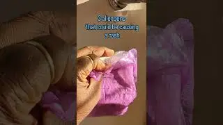 Period pad rash  #sherpax #sherpaxwoman #clothmenstrualpads #padrash #periods #latexallergy