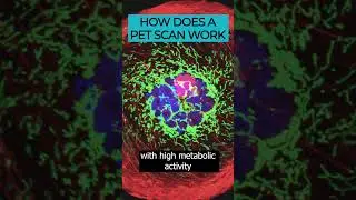 PET Scans: An advanced imaging tool for detecting cancer 🎗️🔍