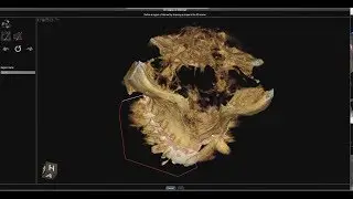 CS 3D Imaging - Region Of Interest Cropping Tool PDIP
