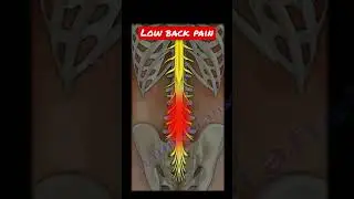 Low back pain #shorts