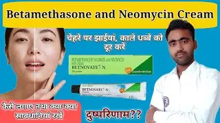 Betnovate n cream | betamethasone, neomycin cream | चेहरे के धब्बे कैसे दूर करें?#skincare