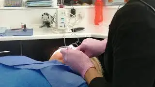 The Dental Wand Explained | Fear of Injections