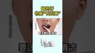 I heard that missing teeth can grow back  #dentist #teeth