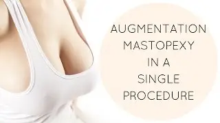 Augmentation Mastopexy in a Single Procedure Single Stage | Edelstein Cosmetic