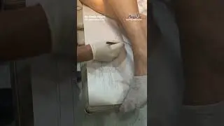 &iquest;C&oacute;mo funciona la ESCLEROTERAPIA paratratamiento de venas de peque&ntilde;o calibre (ara&ntilde;as vasculares)?