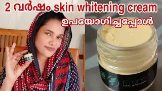 രണ്ടുവർഷം സ്കിൻ വൈറ്റനിങ് ക്രീം ഉപയോഗിച്ച എന്റെ അവസ്ഥ ftun skin whitening cream