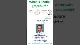 What is Bentall procedure?