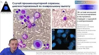 &laquo;17 хромосома в онкогематологии&raquo; Трейлер к уроку.
