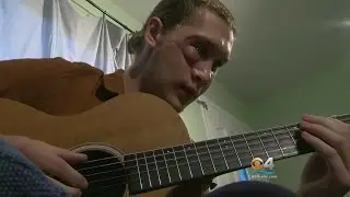 Man Hit By Metal On I-95 Has Stitches Removed From His Face, Prepares For More Surgeries