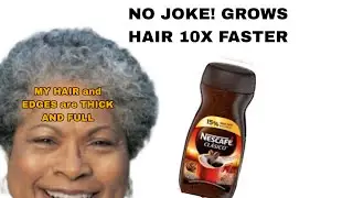 How I use this hair growth recipe with coffee to grow my hair 10x faster! works for all hair types
